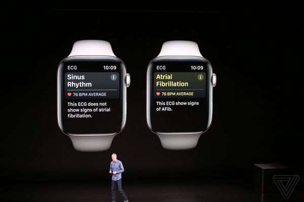 Представлены Apple Watch 4 – новый дизайн, увеличенный экран и электрокардиограмма