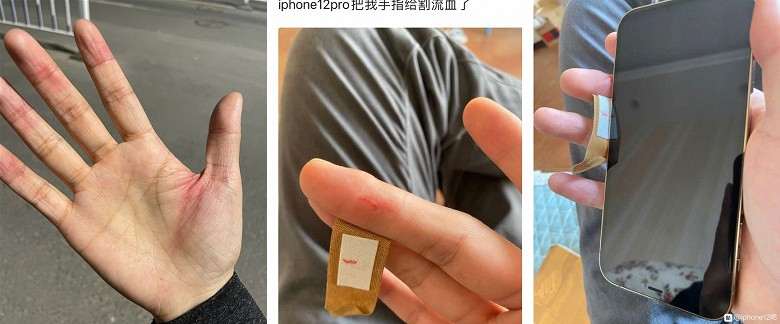 iPhone 12 полон проблем. Краска облазит, грани режут руки, корпус трескается