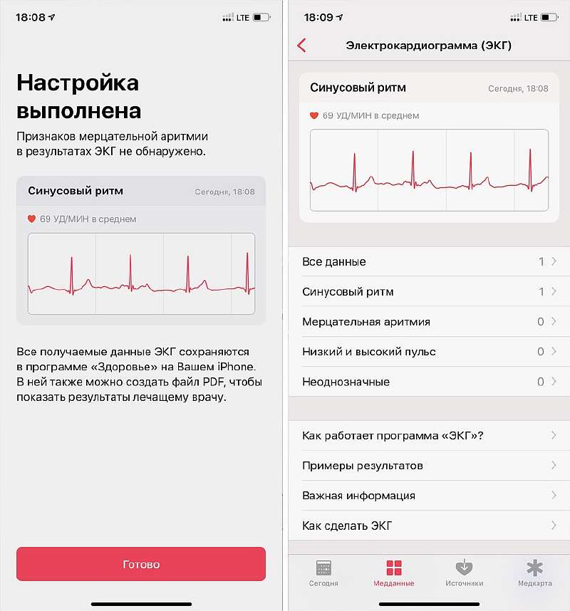 ЭКГ на Apple Watch официально приходит в Россию. Как включить?