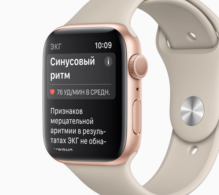 ЭКГ на Apple Watch официально приходит в Россию. Как включить?