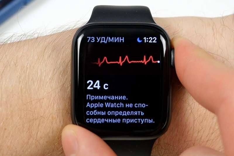 ЭКГ на Apple Watch официально приходит в Россию. Как включить?