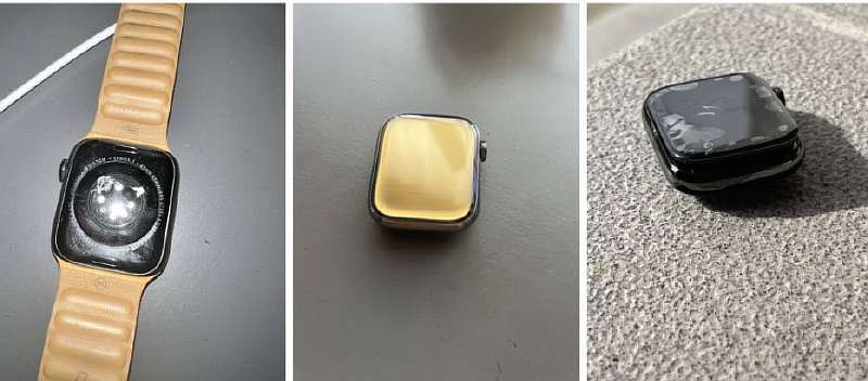 От взрыва Apple Watch пострадал пользователь. Компания пытается замять дело
